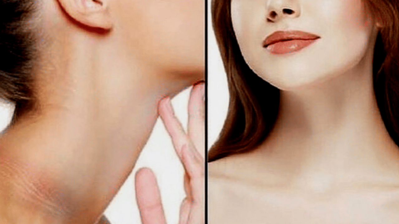 ঘাড়ের কালো দাগ কীভাবে তুলবেন?