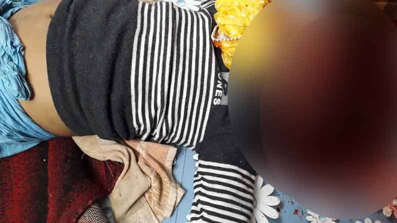 খুবলে গিয়েছে চোখের ওপর থেকে মাথার একাংশ, টিভি দেখার সময় মর্মান্তিক পরিণতি!