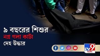 করোনা-চিকিৎসায় নয়া দিশা দেখাবে অ্যান্টিবডির ‘আয়ু’র গবেষণা