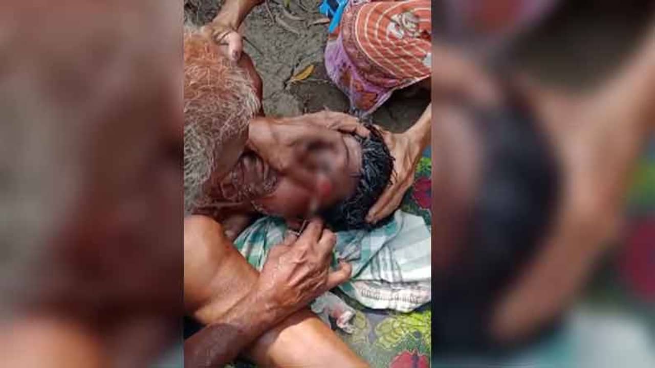 West Bengal Assembly Election 2021: মেরে ফাটিয়ে দেওয়া হল, চোখ ফেটে ঝরঝরিয়ে পড়ল রক্ত! বিজেপি কর্মীর মর্মান্তিক পরিণতি