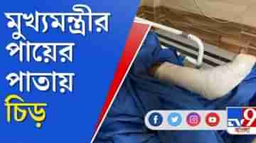 মমতার পায়ের পাতায় চিড়, প্লাস্টার করতে হতে পারে