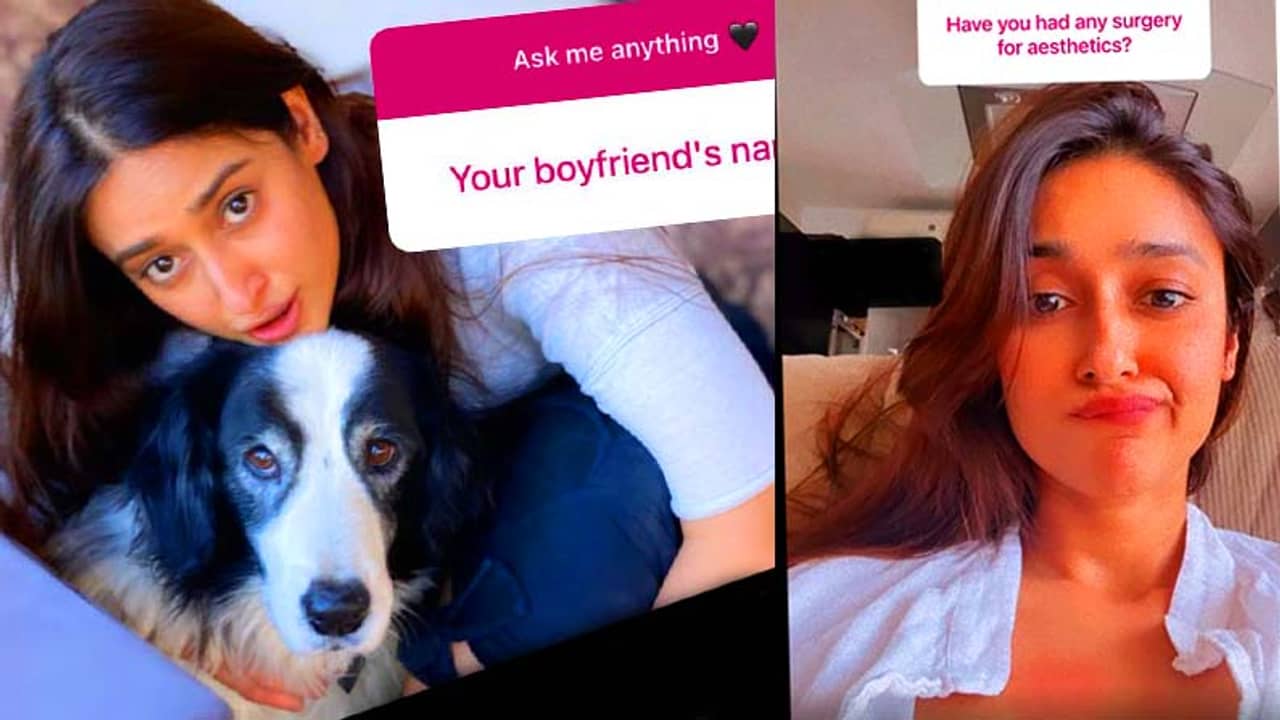 কসমেটিক সার্জারি করেছেন? এক শব্দে উত্তর কী উত্তর দিলেন এলিয়েনা