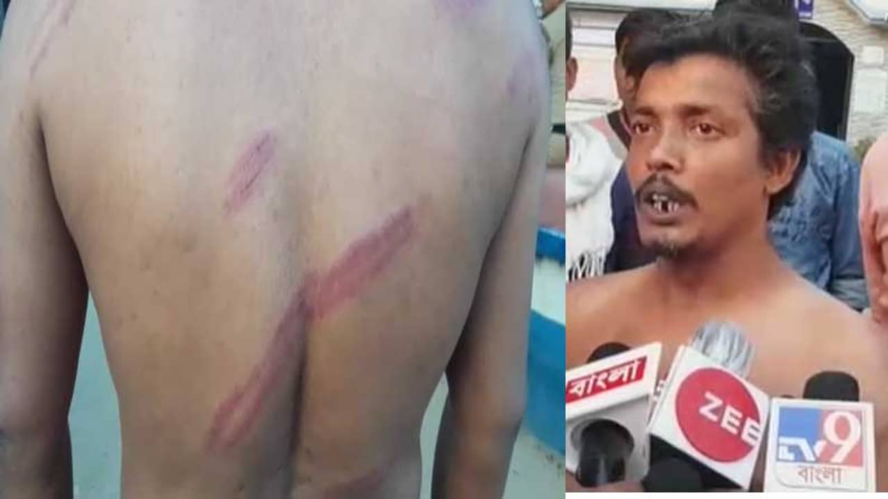 West Bengal Assembly Election 2021 Phase 2: বিজেপির বুথ এজেন্টকে বাঁশপেটা, হাতে-পিঠে জমাট বাঁধল রক্ত