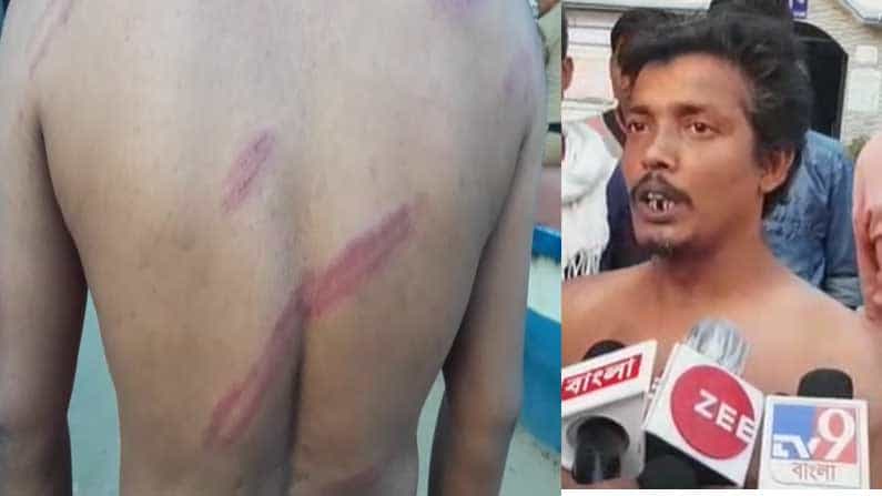 West Bengal Assembly Election 2021 Phase 2: বিজেপির বুথ এজেন্টকে বাঁশপেটা, হাতে-পিঠে জমাট বাঁধল রক্ত