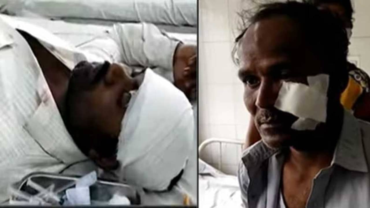 ফাটল মাথা, কাটল গাল; ভোটের আগের দিন ফের উত্তপ্ত শীতলকুচি