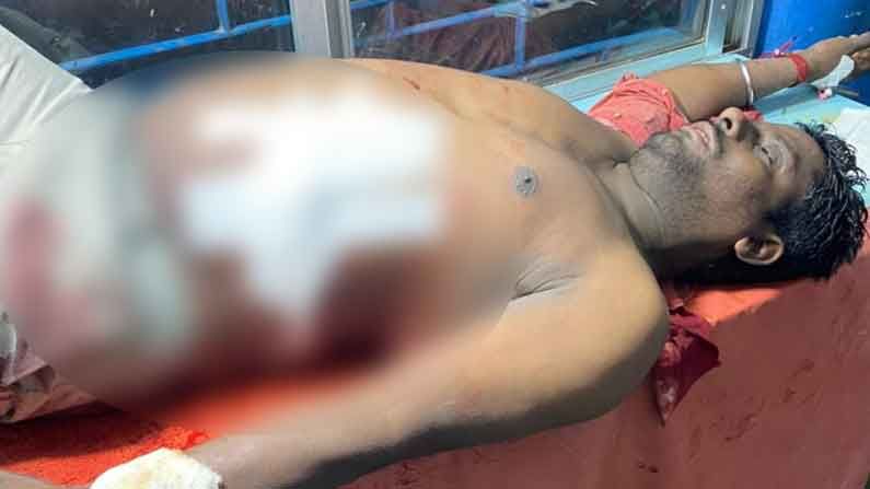 তৃণমূল কর্মীর পেটে ঢোকানো হল ভোজালি, কাটা হল কান! অভিযোগ ঘিরে উত্তপ্ত বলাগড় তৃণমূল কর্মীর পেটে ঢোকানো হল ভোজালি, কাটা হল কান! অভিযোগ ঘিরে উত্তপ্ত বলাগড়