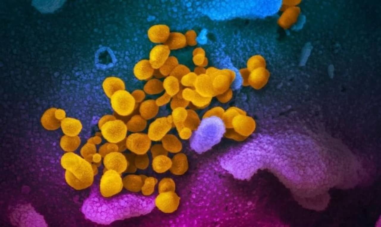 কালো ও সাদার থেকেও মারাত্মক এই হলুদ ছত্রাক! উপসর্গ কী, কারা আক্রান্ত হতে পারেন, সবটা জেনে নিন...