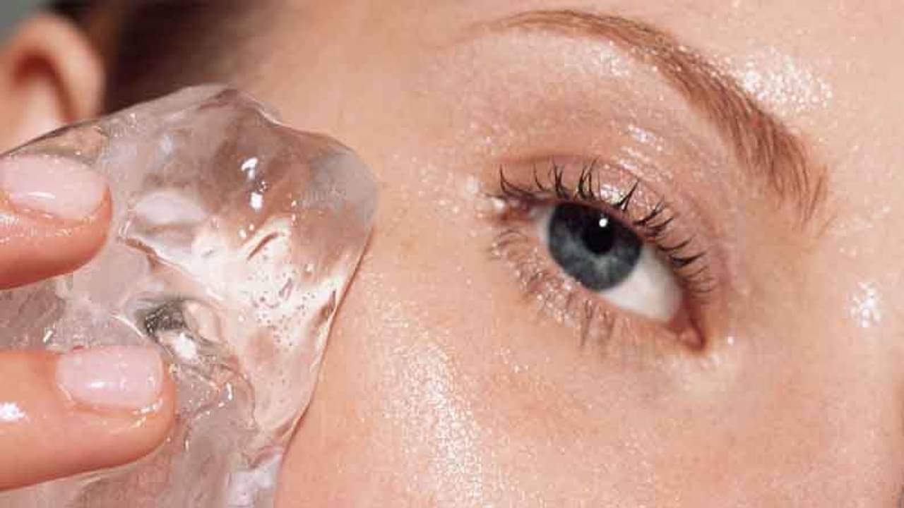 গরমকালে চোখের চারপাশে জ্বালাভাব, এই সমস্যার সমাধানে মেনে চলুন কয়েকটি ঘরোয়া টোটকা