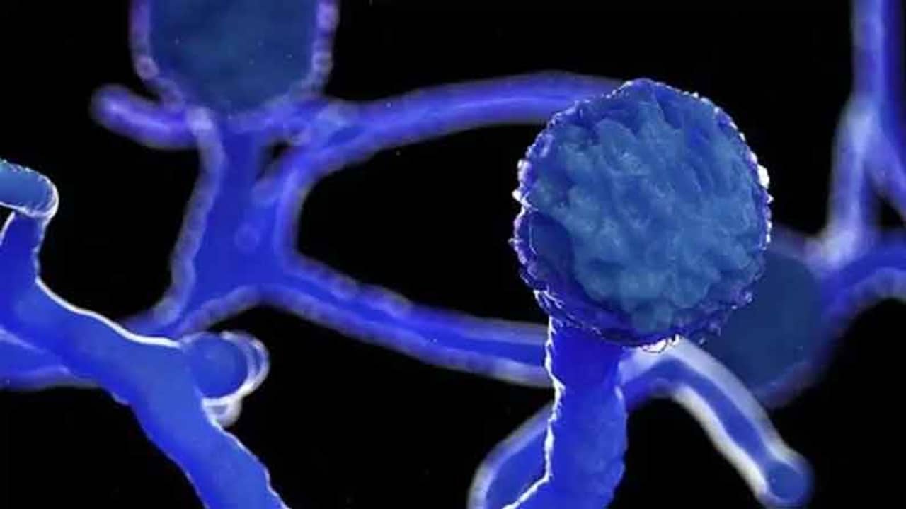 বিহারে লাফিয়ে বাড়ছে মিউকোরমাইকোসিস সংক্রমণ, ২৪ ঘণ্টায় আক্রান্ত ৩৯