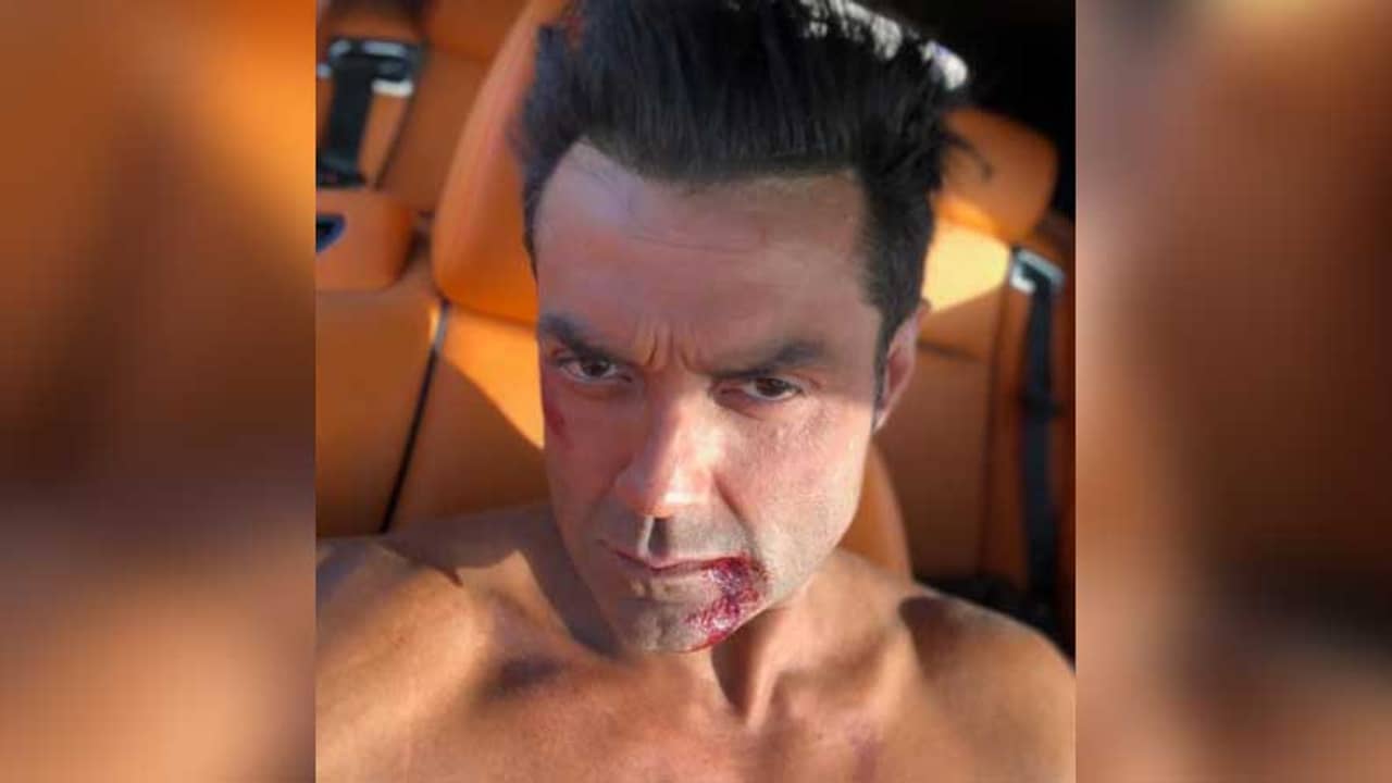 রক্তমাখা ছবিতে পুরনো কোন স্মৃতি উস্কে দিলেন ববি দেওল?