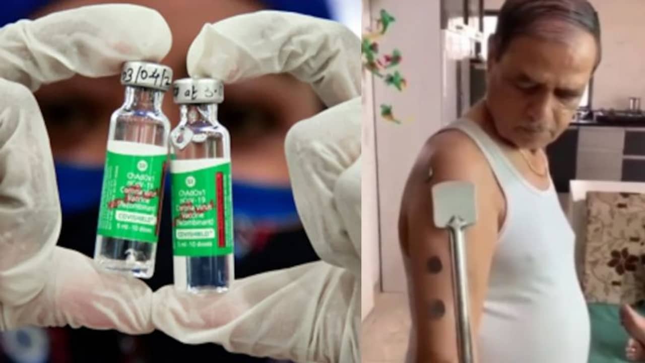 ভিডিয়ো: কোভিশিল্ড নেওয়ার পর দেহ হয়েছে চুম্বক, আটকে যাচ্ছে কয়েন-খুন্তি