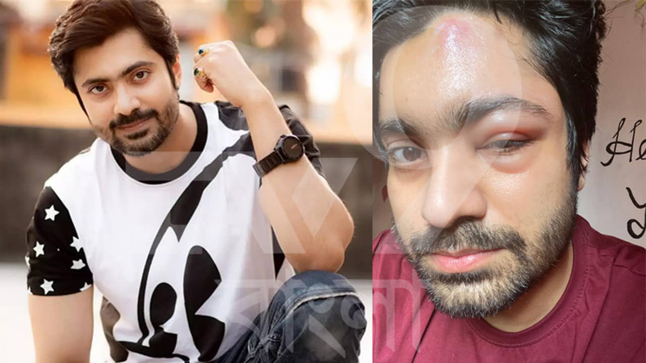 গুরুতর অসুস্থ হয়ে হাসপাতালে ভর্তি অভিনেতা গৌরব রায়চৌধুরী