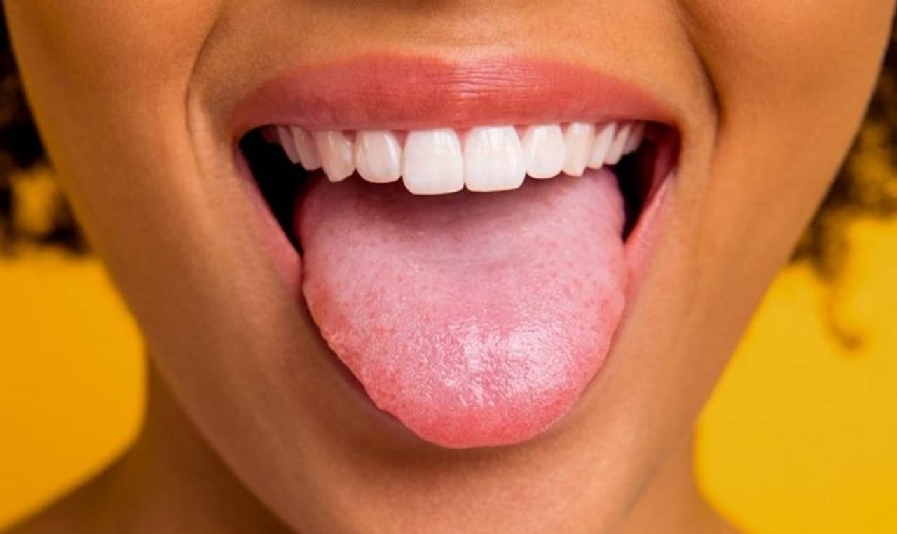 জিভের রঙ নীল না কালো? জিভের রঙ দেখে বুঝে নিন আপনি কোন রোগে আক্রান্ত!