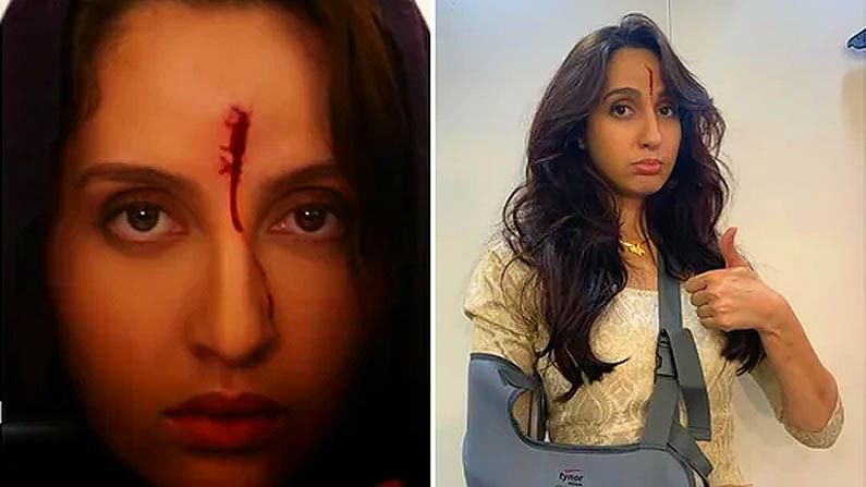 Nora Fatehi: বন্দুকের নল মাথায় লেগে রক্তারক্তি কান্ড! চোট নিয়ে শুট চলেছে নোরার