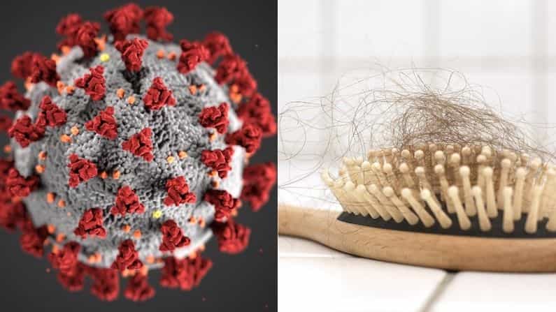 Coronavirus: করোনা থেকে সুস্থ হওয়ার পর কেন বেশি পরিমাণে ঝরে যাচ্ছে চুল? Coronavirus: করোনা থেকে সুস্থ হওয়ার পর কেন বেশি পরিমাণে ঝরে যাচ্ছে চুল?