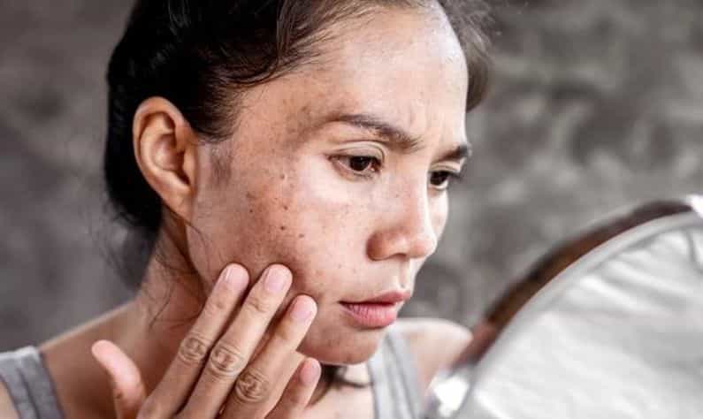 Vitamin A for skin: ত্বক ও চুলের যত্নে ভিটামিন এ-র ভূমিকা রয়েছে অনেক! Vitamin A for skin: ত্বক ও চুলের যত্নে ভিটামিন এ-র ভূমিকা রয়েছে অনেক!