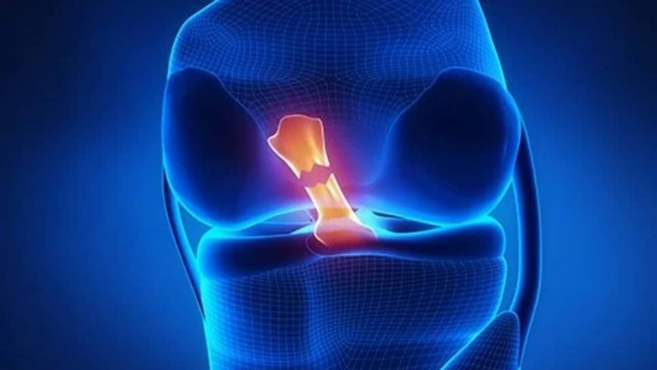 Ligament Injury: হাঁটুর এই বিশেষ জায়গায় চোট লাগলে তা কোনোদিনও সেরে ওঠে না