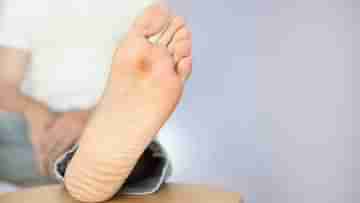 Diabetic Foot Ulcer: ডায়বেটিসের রোগী? এখনই সতর্ক হন, নাহলেই ঘটতে পারে ফুট আলসার!