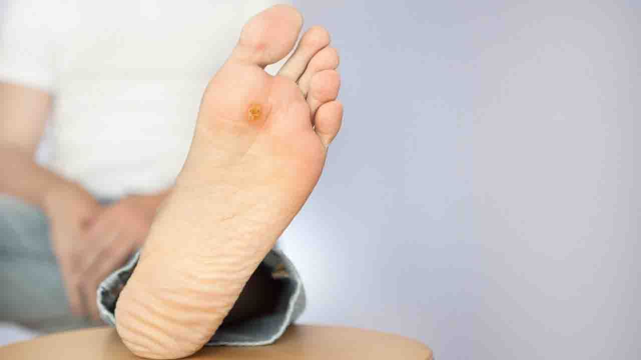 Diabetic Foot Ulcer: ডায়বেটিসের রোগী? এখনই সতর্ক হন, নাহলেই ঘটতে পারে ফুট আলসার!