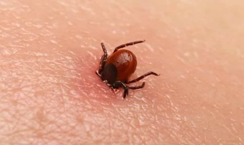 Scrub Typhus: আতঙ্কের নয়া নাম স্ক্রাব টাইফাস, জেনে নিন এই ভাইরাসের লক্ষণ ও চিকিত্সা Scrub Typhus: আতঙ্কের নয়া নাম স্ক্রাব টাইফাস, জেনে নিন এই ভাইরাসের লক্ষণ ও চিকিত্সা