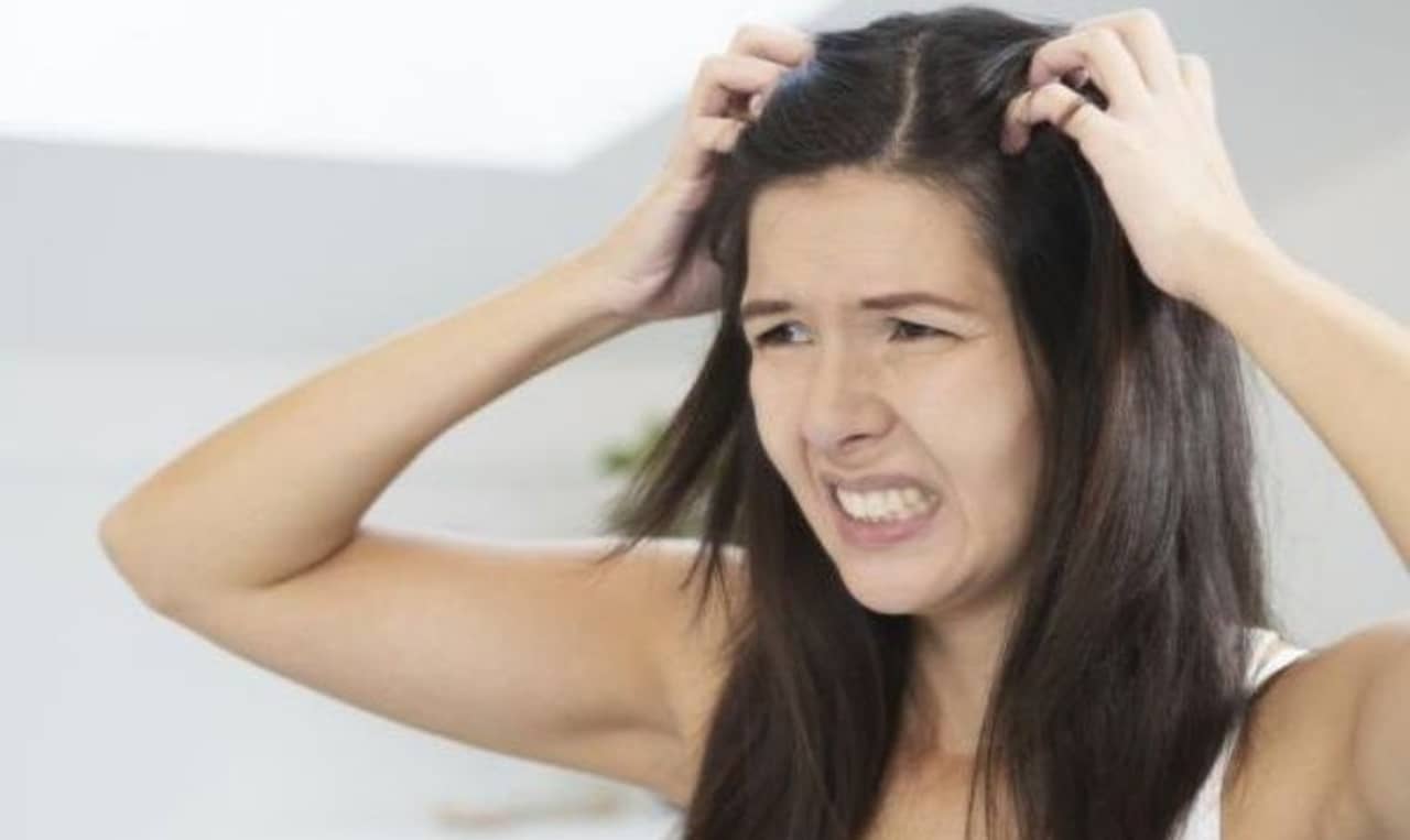 Ayurvedic Remedies: বাজারচলতি পণ্যে নয়, সাধারণ ও সহজ ৫ আয়ুর্বেদিক উপায়েই চটপট দূর করুন খুশকির সমস্যা!