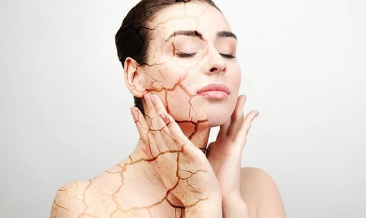 Dry Skin: শুষ্ক ত্বককে হাইড্রেট রাখতে রইল কিছু সহজ ও গুরুত্বপূর্ণ টিপস