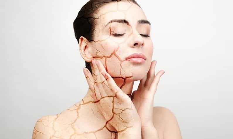 Dry Skin: শুষ্ক  ত্বককে হাইড্রেট রাখতে রইল কিছু সহজ ও গুরুত্বপূর্ণ টিপস