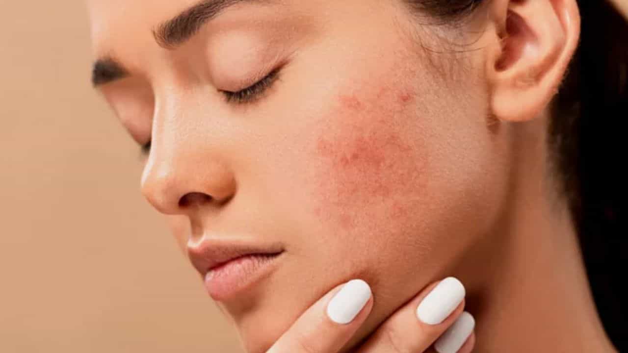 Benefits of Vitamin D: ভিটামিন ডি-এর অভাবে ত্বকের মারাত্মক রকমের ক্ষতি হতে পারে, নিরাময়ের উপায় জেনে নিন...