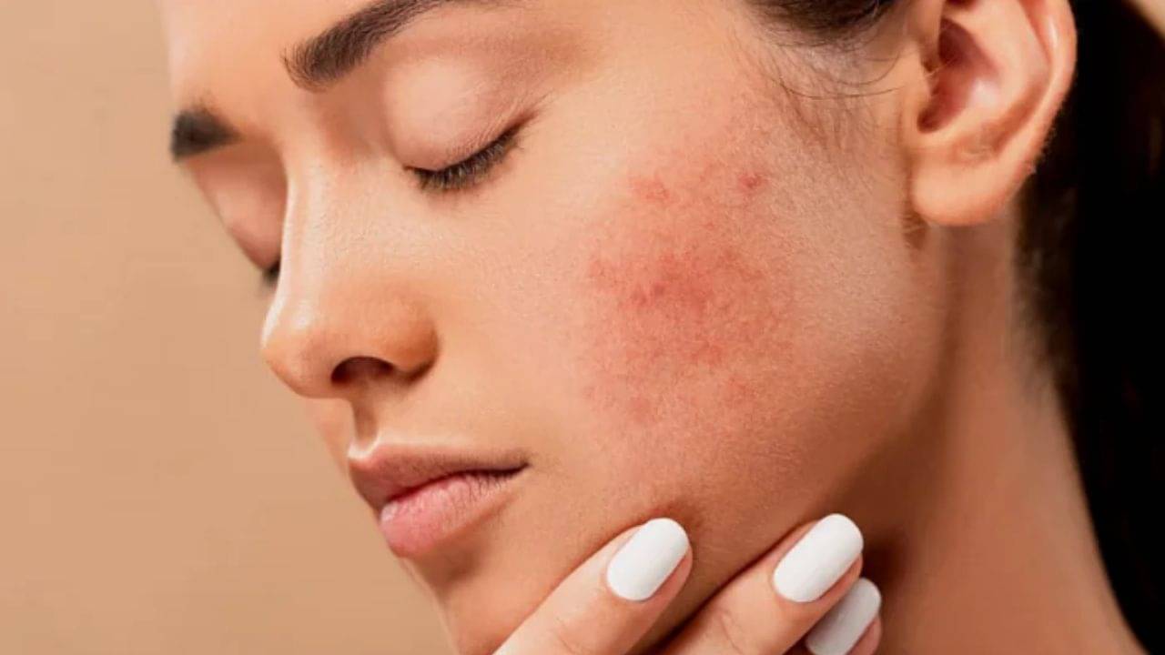 Benefits of Vitamin D: ভিটামিন ডি-এর অভাবে ত্বকের মারাত্মক রকমের ক্ষতি হতে পারে, নিরাময়ের উপায় জেনে নিন...