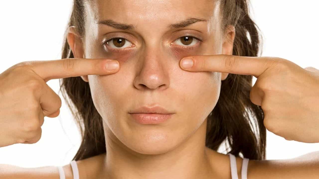 Dark Circles Care: স্ক্রিনটাইম না কমিয়েও কীভাবে ডার্ক সার্কেলের হাত থেকে বাঁচবেন, জেনে নিন... Dark Circles Care: স্ক্রিনটাইম না কমিয়েও কীভাবে ডার্ক সার্কেলের হাত থেকে বাঁচবেন, জেনে নিন...