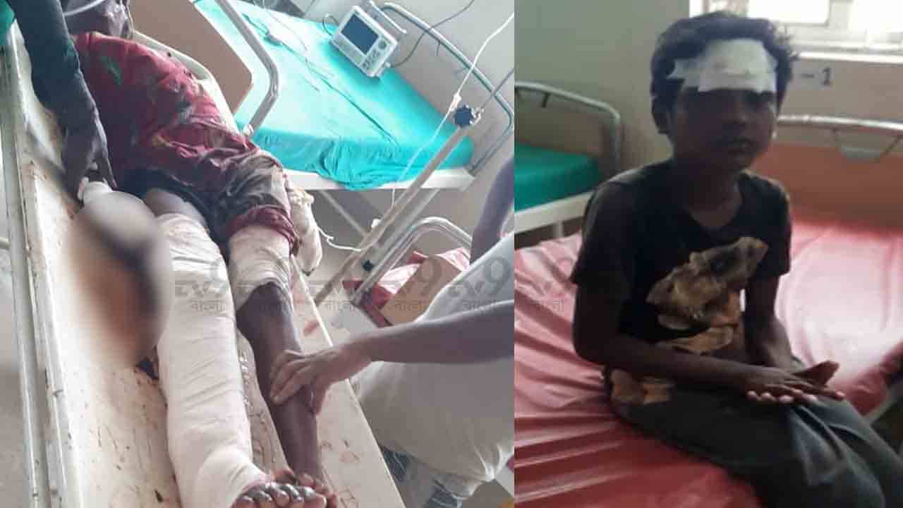 Big News: ভয়ঙ্কর বিস্ফোরণে কেঁপে উঠল নন্দীগ্রাম! নিহত এক নাবালিকা, আশঙ্কাজনক ১