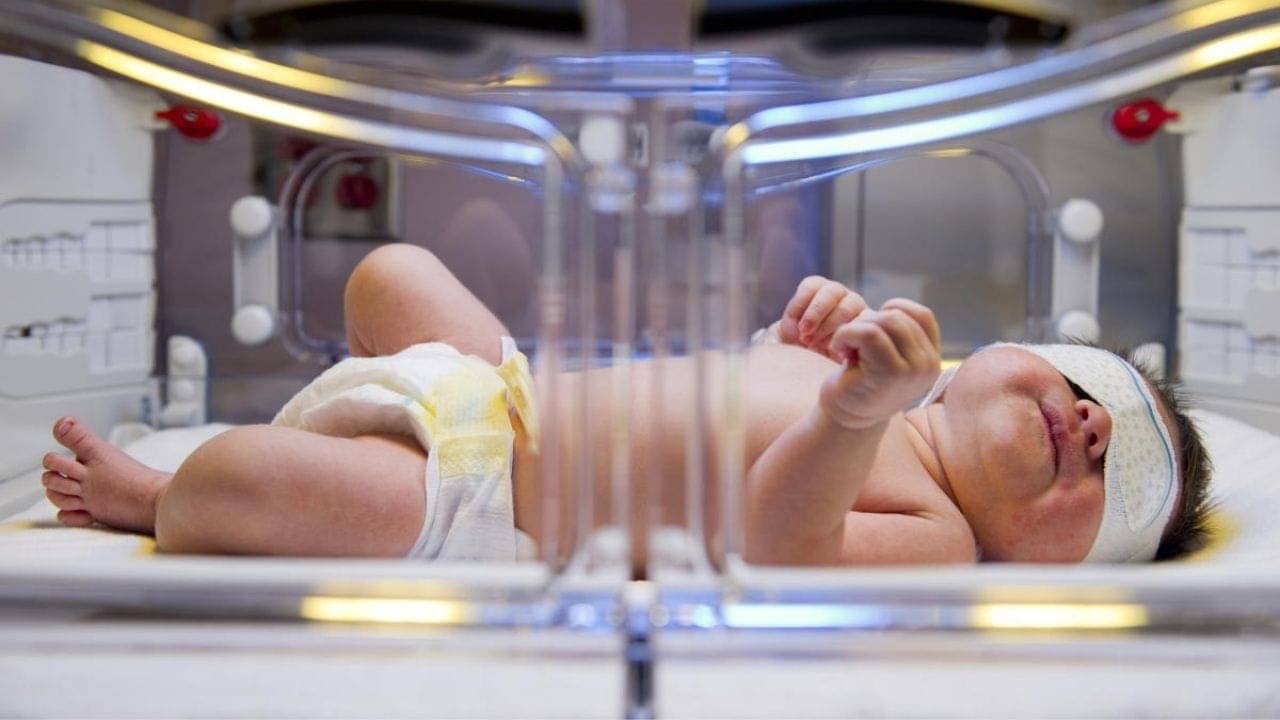 Newborn Jaundice: নবজাতকের মধ্যে জন্ডিসের সমস্যা কি সাধারণ? দেখে নিন এর উপসর্গগুলি কী কী