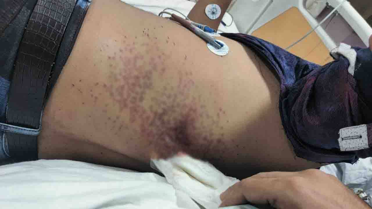 Firing in Kolkata : ফের রাতের কলকাতায় গুলি, জখম প্রোমোটার