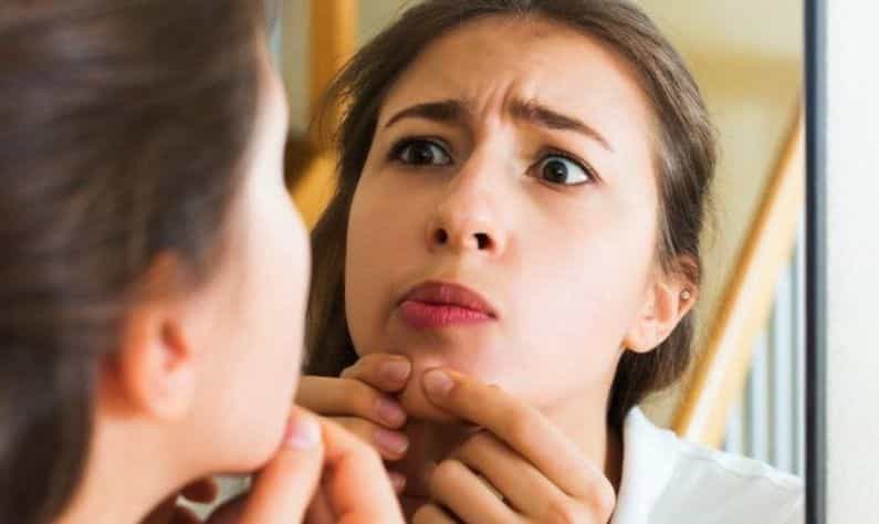 Pimple: ব্রণ খুঁটে ফেলার অভ্যেস রয়েছে? এক মিনিটের মধ্যে জ্বালাভাব কমান এই সহজ উপায়ে! Pimple: ব্রণ খুঁটে ফেলার অভ্যেস রয়েছে? এক মিনিটের মধ্যে জ্বালাভাব কমান এই সহজ উপায়ে!