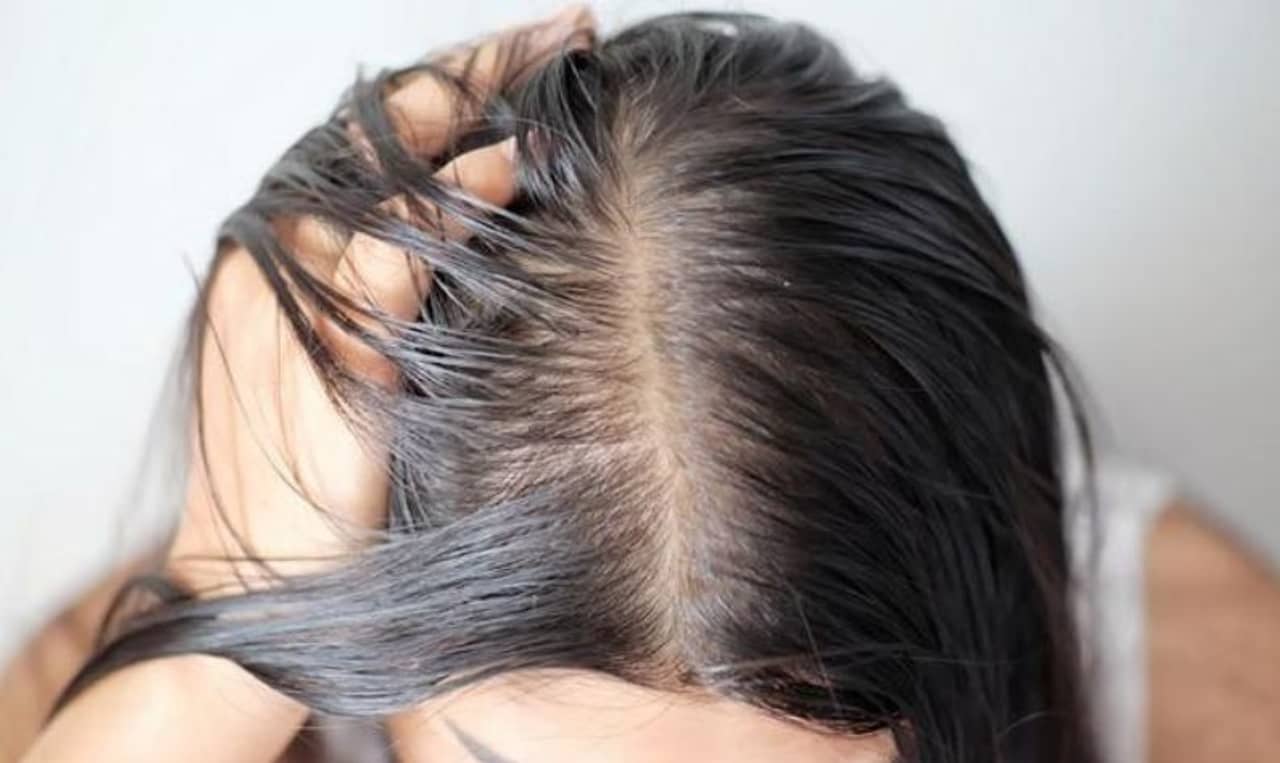 Greasy Scalp: দামি শ্যাম্পুর পরও তেল জ্যাবজ্যাবে স্ক্যাল্প! কী করলে উপকার পাবেন, রইল ৫টি টিপস