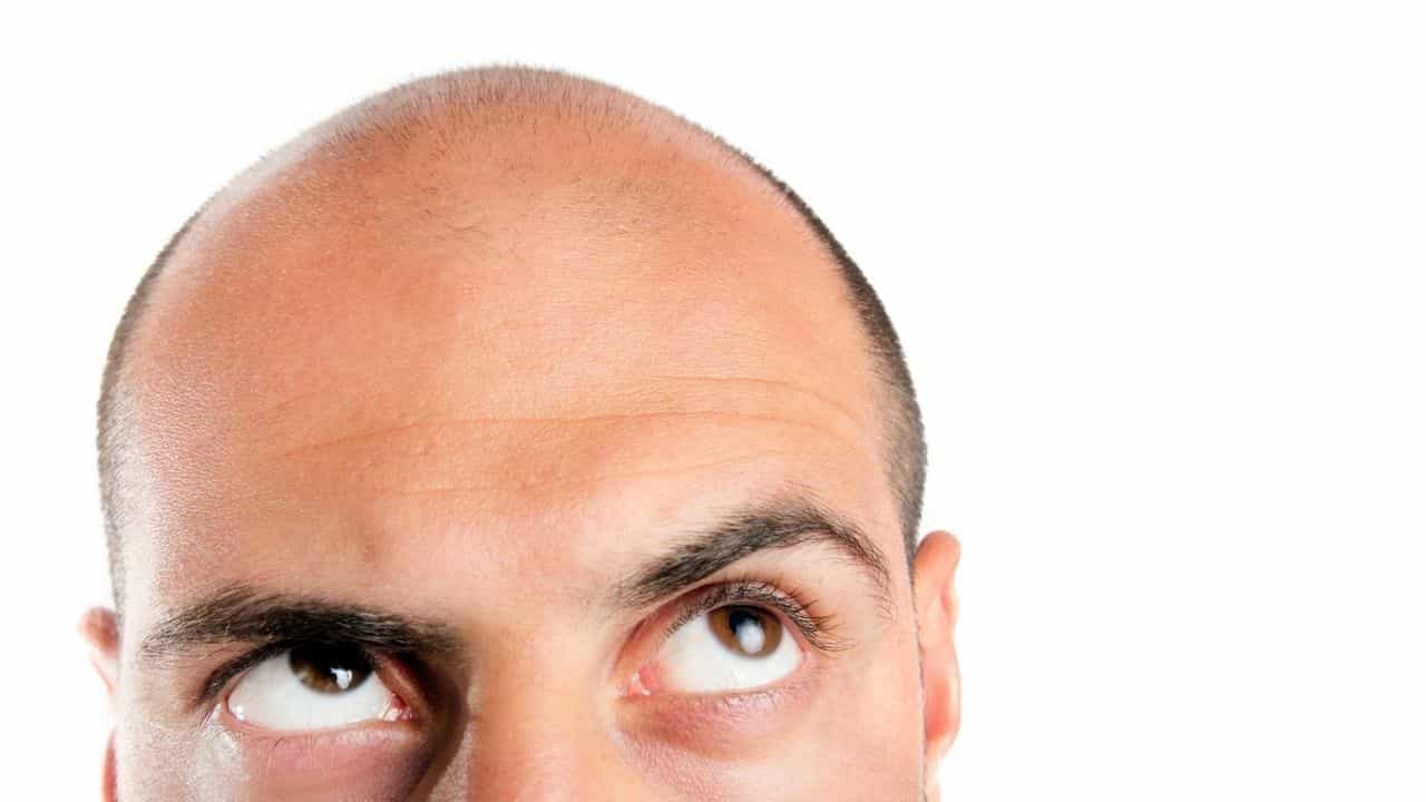 Hair Fall in Men: পুরুষদের কম বয়সে চুল পাতলা হয়ে যাওয়া বা চুল পড়ে যাওয়ার সমস্যা থেকে মুক্তির উপায়গুলো জেনে নিন... Hair Fall in Men: পুরুষদের কম বয়সে চুল পাতলা হয়ে যাওয়া বা চুল পড়ে যাওয়ার সমস্যা থেকে মুক্তির উপায়গুলো জেনে নিন...
