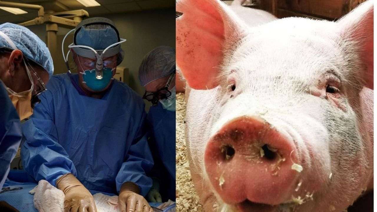 Kidney Transplant: মানবদেহে প্রথম শূকরের কিডনি প্রতিস্থাপন! কী ফল মিলল গবেষণায়?