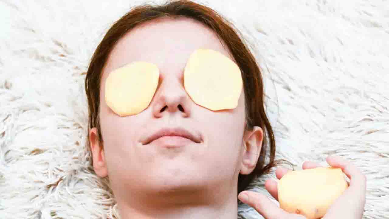 Dark Circle: রান্নাঘরে থাকা আলুই দূর করবে আপনার ডার্ক সার্কেলের সমস্যা! কীভাবে দেখে নিন