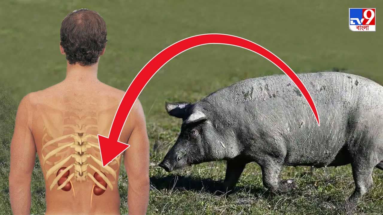 Kidney Transplant: শূকরের কিডনি মানুষে শরীরে! কিডনি সঙ্কট কি মিটতে চলেছে? কী বলছেন চিকিৎসকরা