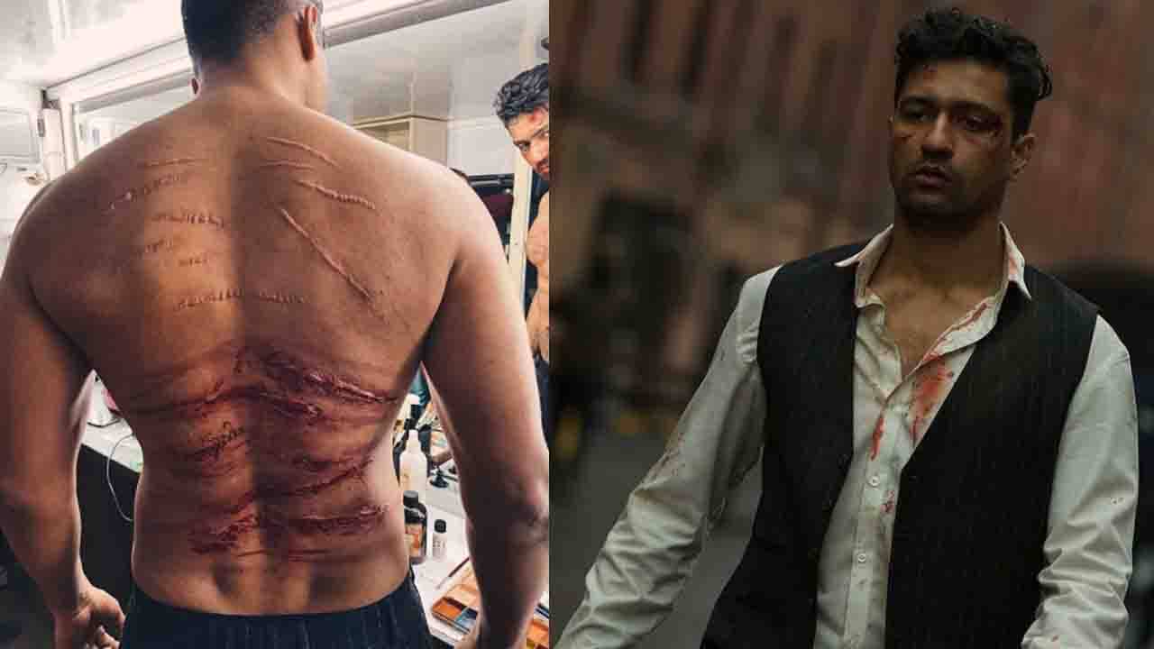 Vicky Kaushal: সারা পিঠে আঘাতের চিহ্ন, সর্দার উধাম-এর শুটিং করতে গিয়ে একাধিকবার আহত হয়েছিলেন ভিকি?