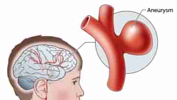 Brain Bleeding from Aneurysm: অনিদ্রার কারণে মস্তিস্কে হতে পারে রক্তপাতের মতো ভয়ঙ্কর ঘটনা, জেনে নিন নিরাময়ের উপায়...