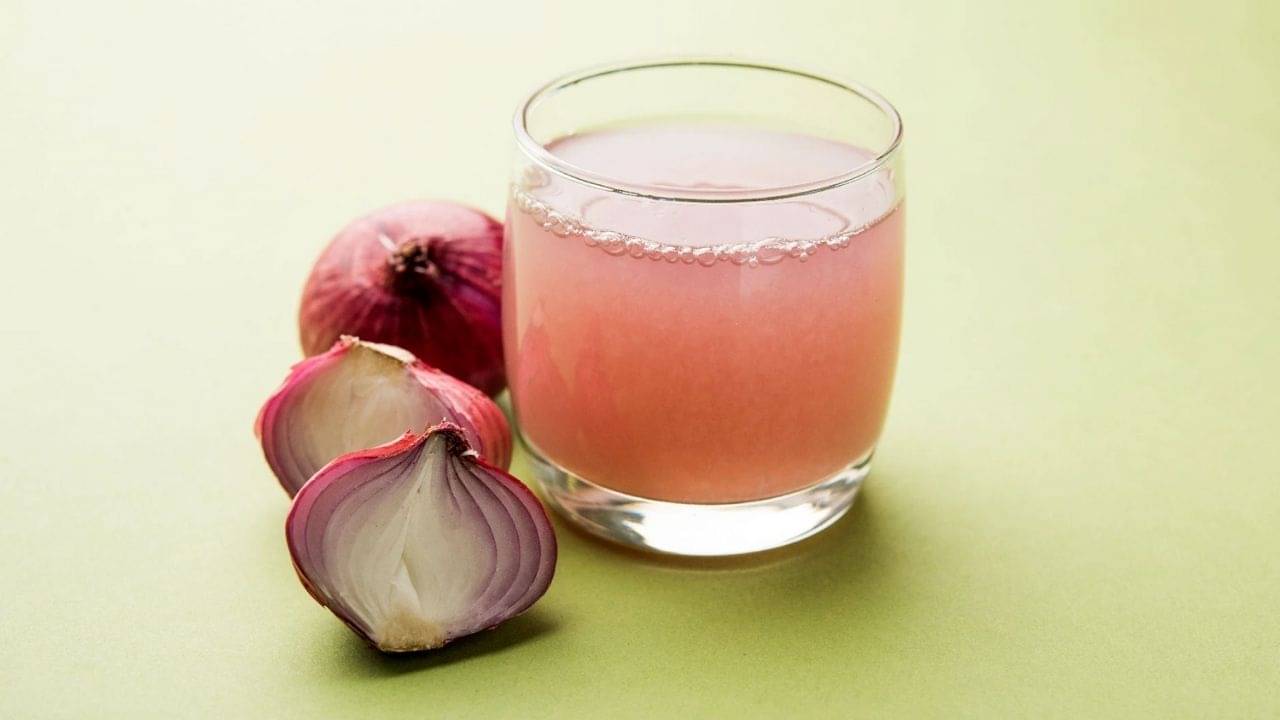 Benefits of Onion: খুশকি নিরাময়ের জন্য পেঁয়াজের রসের উপকারিতা অনেক, কী উপায়ে মাথায় নেবেন পেঁয়াজের রস?