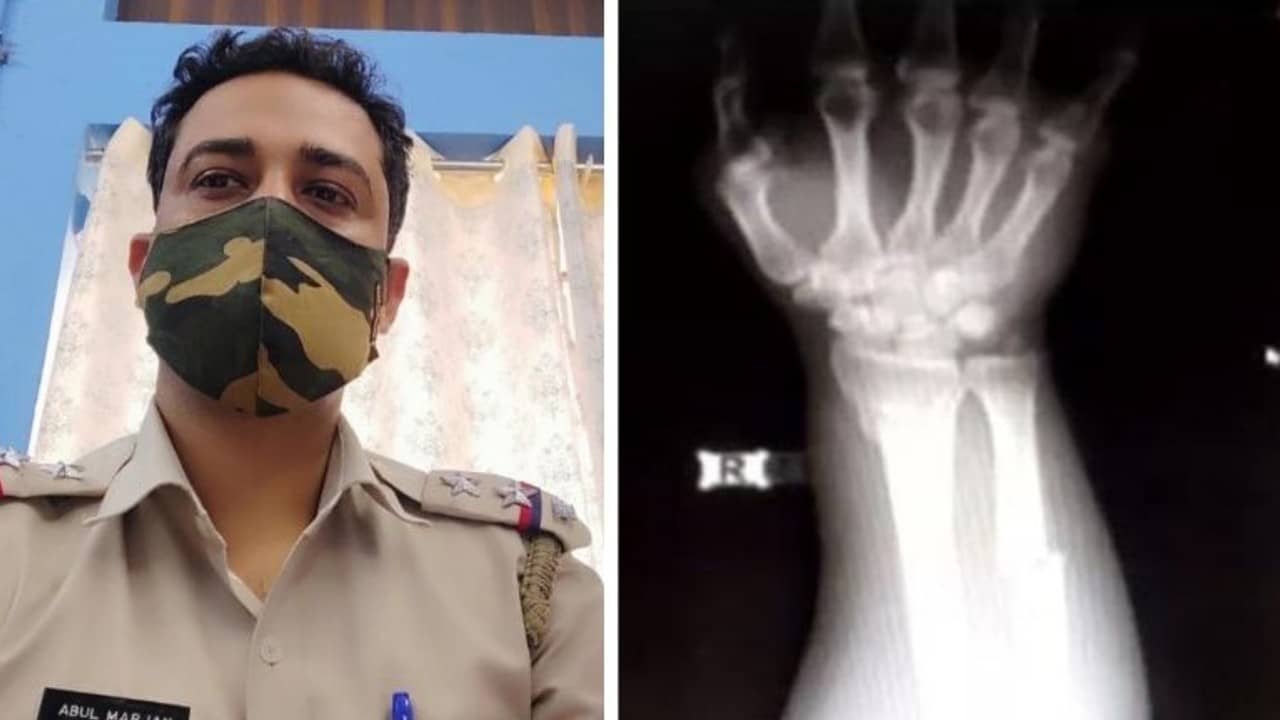 Maheshtala Police: রাস্তা থেকে বাইক সরাতে বলাই অপরাধ, পুলিশের বেধড়ক মারে হাড়গোড় ভাঙল নাগরিকের