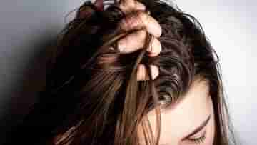 Oily Hair Care: তেলতেলে চুলের কারণে শীতকালে নানা ধরনের সমস্যা হয়, সেগুলোর সম্বন্ধে জেনে নিন...