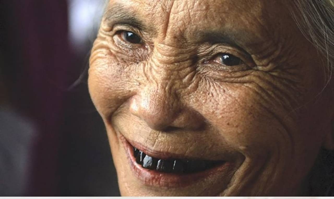 Oral Care Tips: দাঁতের কালো দাগ দূর করতে রইল কিছু ভেষজ ও সহজ ঘরোয়া উপায়! ফল পাবেন গ্যারান্টি