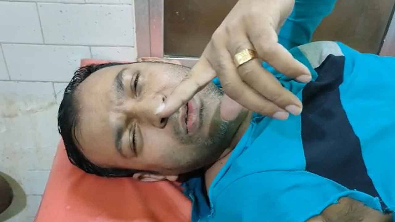 Jalpaiguri Snatching: সবে বাইকে উঠছিলেন, আচমকাই পিছন থেকে হামলা! ব্যবসায়ীর সোনার চেন, টাকা ছিনতাই