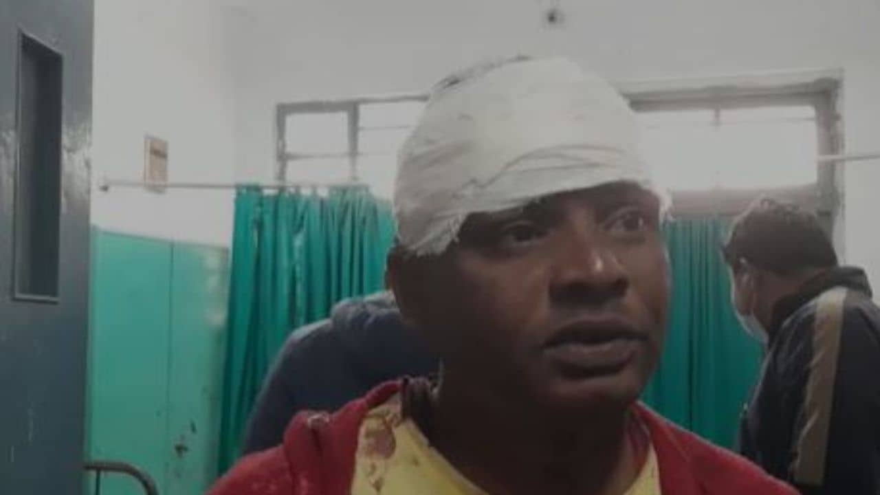 Acid Attack: আদালত থেকে স্ত্রীকে তুলে নিয়ে গিয়ে অ্যাসিড ছুঁড়লেন স্বামী!