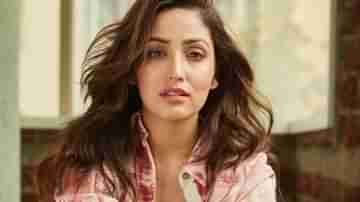 Yami Gautam: নিজেই চর্মরোগে আক্রান্ত হয়েছিলেন ফরসা হওয়ার ক্রিমের মুখ ইয়ামি