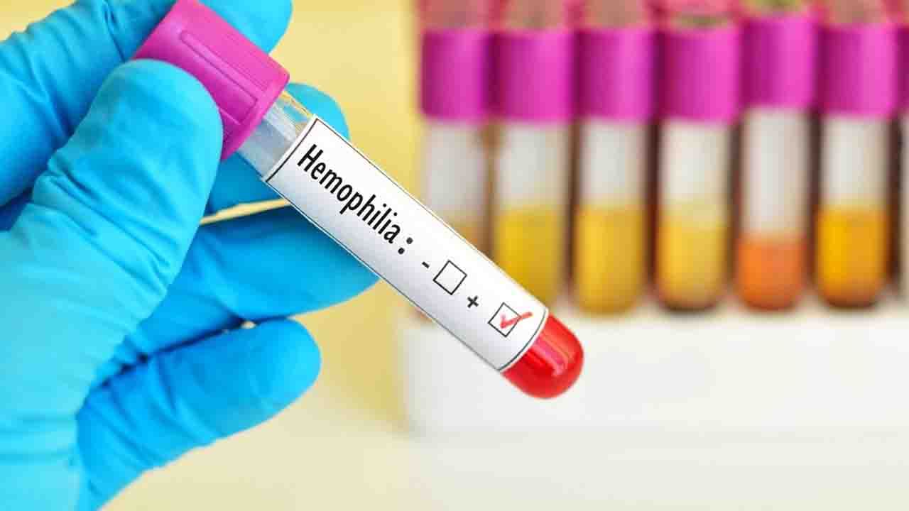 Hemophilia Treatment: টাকা নেই স্বাস্থ্য দফতরের! প্রাণদায়ী ইঞ্জেকশন না পেয়ে ফিরছে হিমোফিলিয়া আক্রান্ত শিশুরা