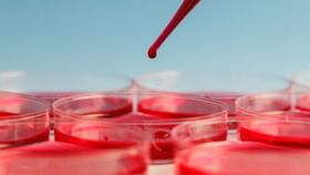 Anemia Prevention: রক্তাল্পতা দূর করতে বিশেষ কিছু খাবার নিয়মিত খেলেই মিলবে উপকার, বিস্তারে জেনে নিন... Anemia Prevention: রক্তাল্পতা দূর করতে বিশেষ কিছু খাবার নিয়মিত খেলেই মিলবে উপকার, বিস্তারে জেনে নিন...
